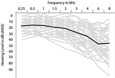 Visual Inhibition Measures Predict Speech-in-Noise Perception Only in People With Low Levels of Education